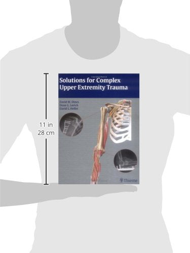 Solutions for Complex Upper Extremity Trauma